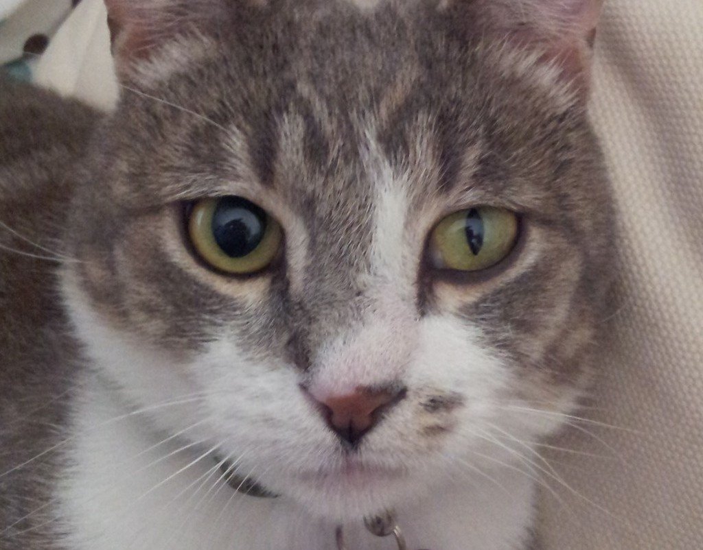 The Unequal Pupil Size: When Something's Not Right 