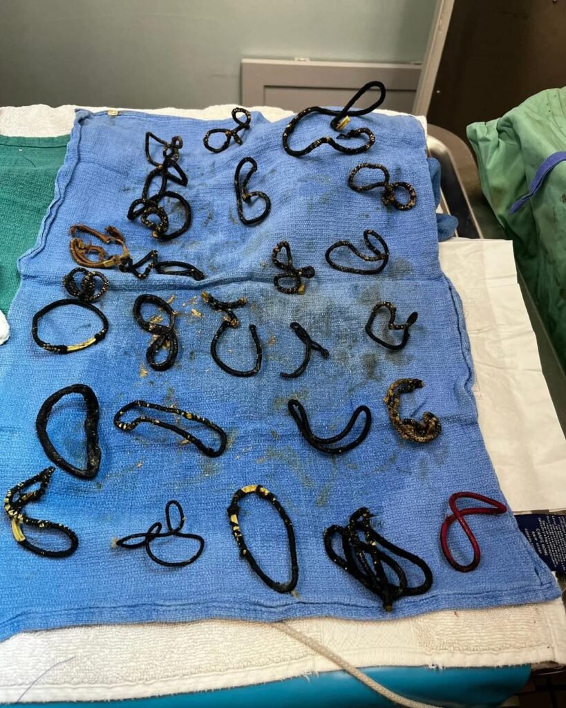 Cat's Life Hangs in Balance: 26 Hair Ties Removed in Emergency Stomach Surgery